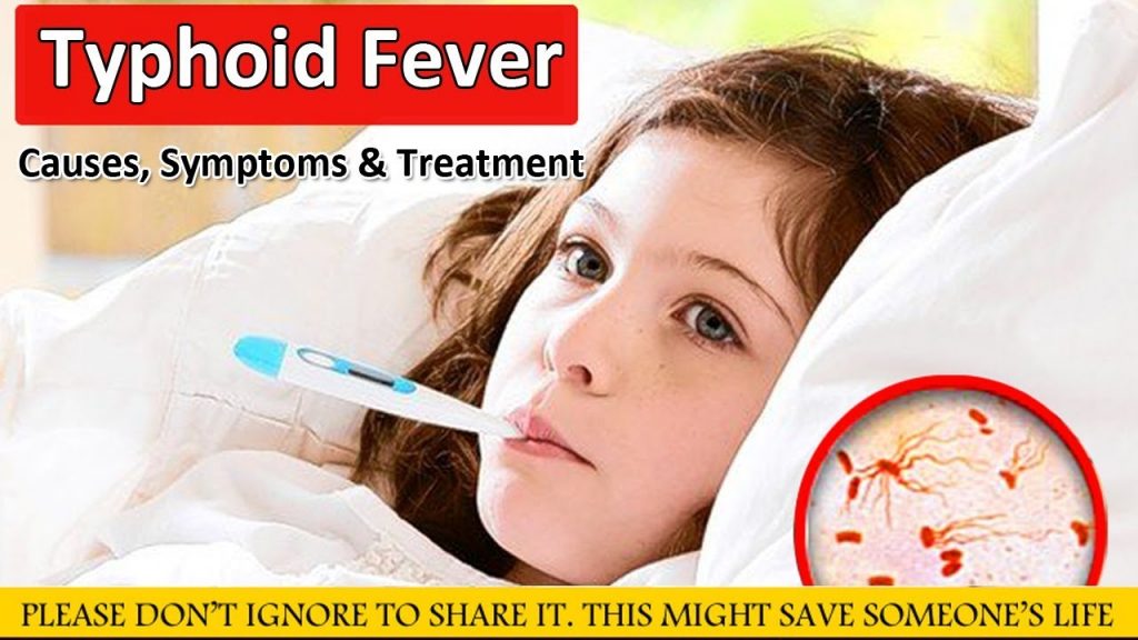 Typhoid Fever होने की मुख्‍य वजह दूषित भोजन और जल